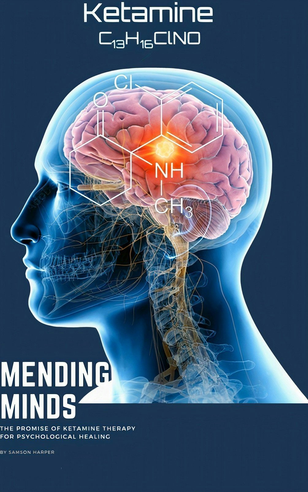 Mending Minds: The Promise of Ketamine Therapy for Psychological Healing